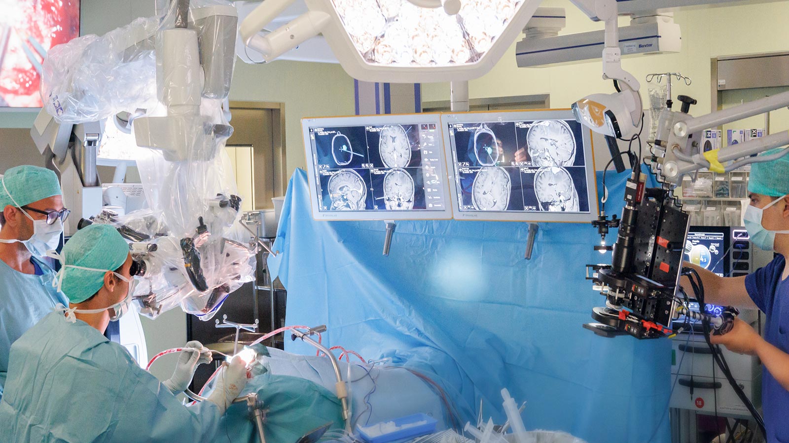 Neurochirurgen führen eine Hirntumoroperation mit dem Prototyp des neuen hochmodernen Mikroskops durch. Mehrere Bildschirme zeigen detaillierte Scans des Gehirns, während innovative Technologie die Präzision des Eingriffs unterstützt.